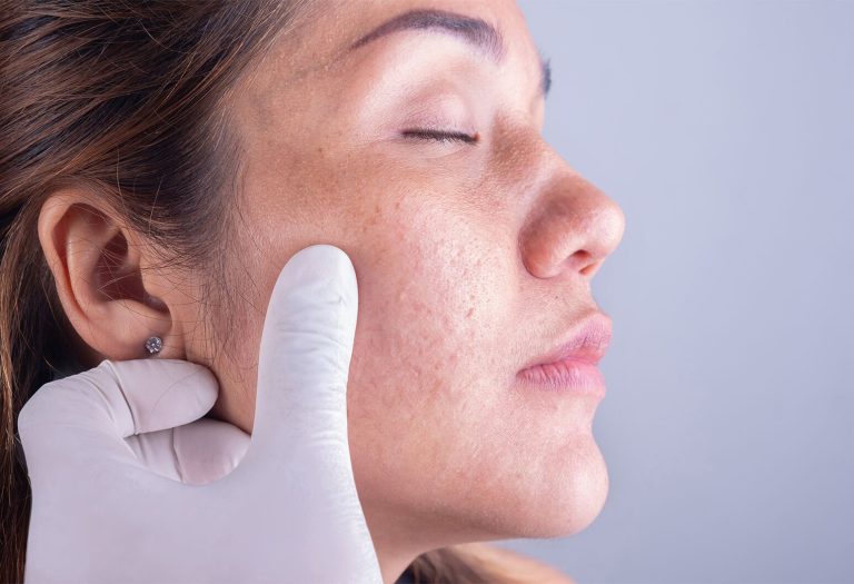 Dr. Mayur Bhobe analyzing a patient’s skin during a consultation in Dubai